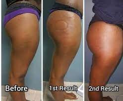 Before & After Results - Before and After Results!