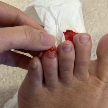 Lotus Nail Salon - Took off a chunk off skin with a pedicure foot filer - Nail Salons Near Me - Mississauga, Ontario Lotus Nail Salon - Took off a chunk off skin with a pedicure foot filer - Nail Salons Near Me - Mississauga, Ontario