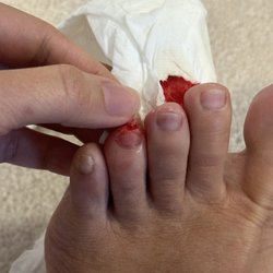 Lotus Nail Salon - Took off a chunk off skin with a pedicure foot filer