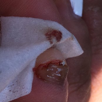Tony's Nail Salon - SHE ADDED EXPIRED VASELINE ON MY NAIL - Nail Salons Near Me - Arleta, California Tony's Nail Salon - SHE ADDED EXPIRED VASELINE ON MY NAIL - Nail Salons Near Me - Arleta, California