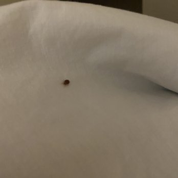 Super 8 by Wyndham Oneida Verona - Bed bugs! - Hotels Near Me - Oneida, New York