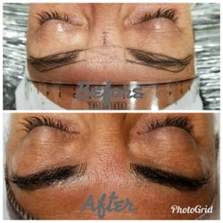 EA Skin Studio - Before & After