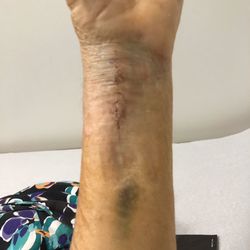 Ventura Orthopedics - Deborah Wooden