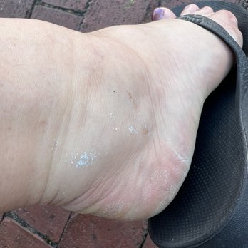 West End Salon And Spa - Caked on foot treatment not thoroughly rinsed off. Didn't notice till I was on the street and it was itchy. - Hair Salons Near Me - Provincetown, Massachusetts West End Salon And Spa - Caked on foot treatment not thoroughly rinsed off. Didn't notice till I was on the street and it was itchy. - Hair Salons Near Me - Provincetown, Massachusetts