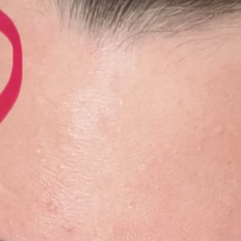 Rouge Medical Spa - !!!!!!!! This is NOT acceptable - Medical Spas Near Me - Sacramento, California Rouge Medical Spa - !!!!!!!! This is NOT acceptable - Medical Spas Near Me - Sacramento, California