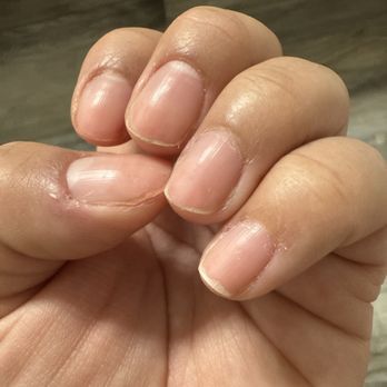 INail Care & Spa - Cuticles are not properly removed. - Nail Salons Near Me - Fresno, California INail Care & Spa - Cuticles are not properly removed. - Nail Salons Near Me - Fresno, California