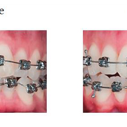 Spectrum Dental