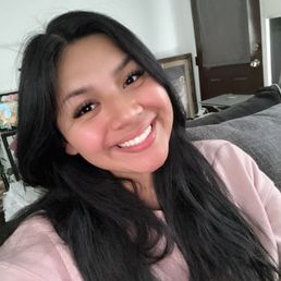 My smile after my results with Dr Albert as my orthodontist My smile after my results with Dr Albert as my orthodontist