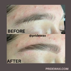 Pride Wax & Med Spa - Before and After