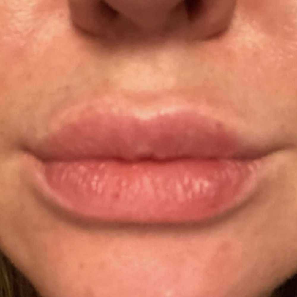 Natural Permanent Makeup - Before - Permanent Makeup Near Me - Bellevue, Washington Natural Permanent Makeup - Before - Permanent Makeup Near Me - Bellevue, Washington