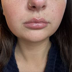 MY BEFORE