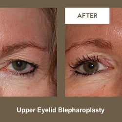 Klapper Eyelid and Facial Plastic Surgery