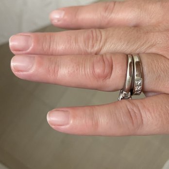 Courtyard by Marriott Milpitas Silicon Valley - Bug bite in my knuckle - Hotels Near Me - Milpitas, California Courtyard by Marriott Milpitas Silicon Valley - Bug bite in my knuckle - Hotels Near Me - Milpitas, California