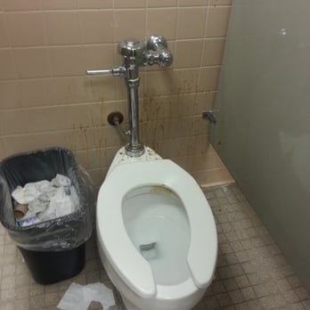 CVS Pharmacy - Completely disgusting and unsanitary. How can you expose your customers to this? - Drugstores Near Me - Buena Park, California CVS Pharmacy - Completely disgusting and unsanitary. How can you expose your customers to this? - Drugstores Near Me - Buena Park, California