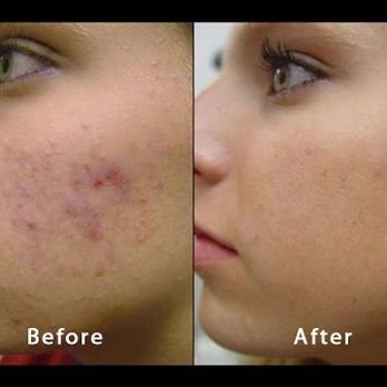 Trimedica Spa - Tattoo Removal Near Me - Farmingville, New York Trimedica Spa - Tattoo Removal Near Me - Farmingville, New York