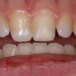 North Salem Dental Care