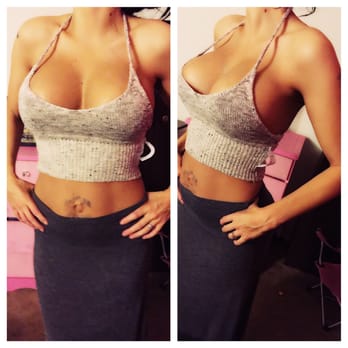Elite Plastic Surgery - Amazing just amazing !! - Plastic Surgeons Near Me - Hollywood, Florida Elite Plastic Surgery - Amazing just amazing !! - Plastic Surgeons Near Me - Hollywood, Florida