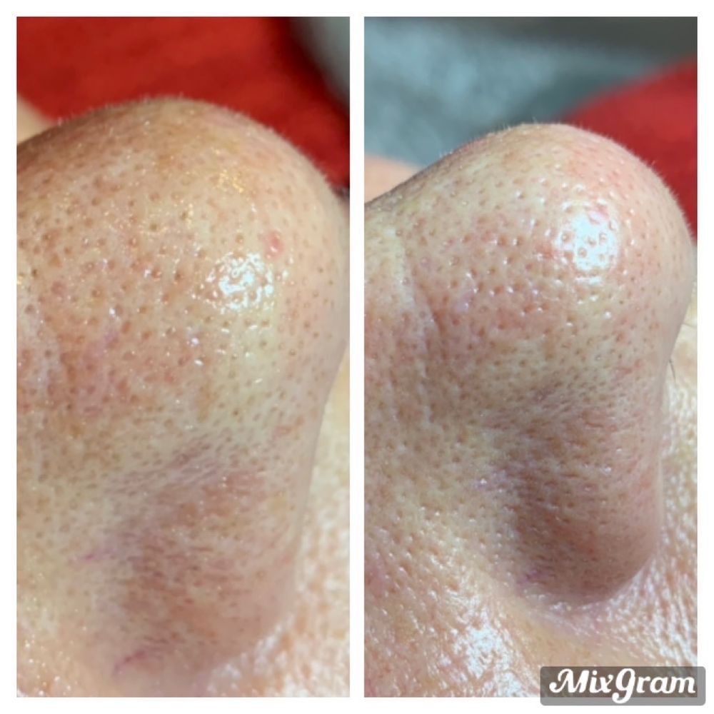 Purity Medical Spa