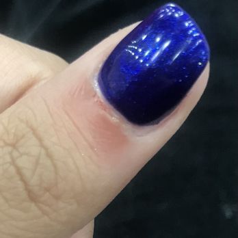 Lavish Lounge nails  - My poor daughter's cuticle. This is only the thumb, but all of them looked very similar. They are now inflamed the next day. - Nail Salons Near Me - Folsom, California