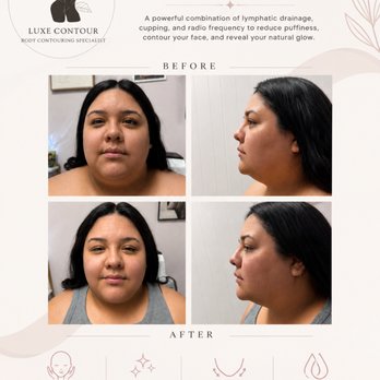 Luxe Contour - Body Contouring Near Me - Ontario, California Luxe Contour - Body Contouring Near Me - Ontario, California