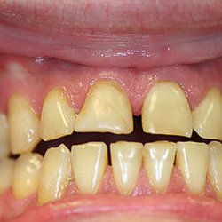 Covenant Family Dental Care
