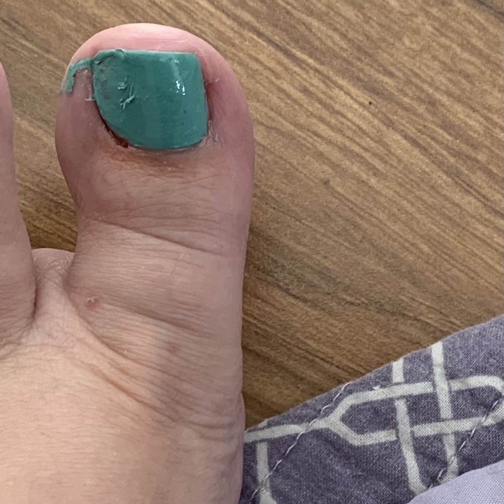Toe