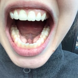 Saad Smiles Dentistry - Which one of these is not like the other? Bet ya cant tell.