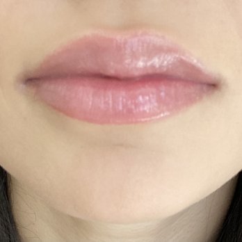 Gig Harbor Aesthetics - Skin Care Near Me - Gig Harbor, Washington