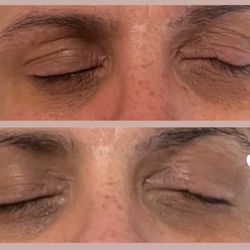Restorative Skin & Body - Before & After NuFACE Microcurrent Treatment
