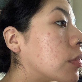 Az Skin Rehab - september 27 - Day Spas Near Me - Chandler, Arizona
