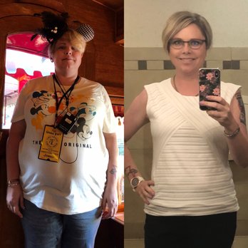 Steven Patching, MD - 92 pounds lost! - Surgeons Near Me - Sacramento, California