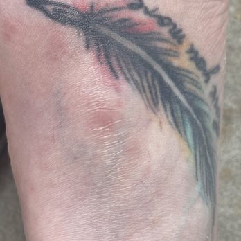 The Katy Nails & Spa - 2 weeks later and it is now a scar. - Nail Salons Near Me - Greenville, Texas