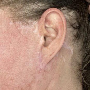 Blackledge Face Center - Cosmetic Surgeons Near Me - Jackson, Mississippi