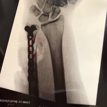 Eric L. Giang, D.O - Orthopedists Near Me - Modesto, California
