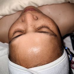 After Basic Essential Glow Facial