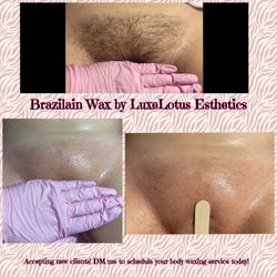 LuxeLotus Esthetics