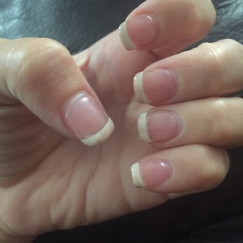 Pro Nails - This is what my nails look like a week after having them done. I have never had nails turned color like this before. - Nail Salons Near Me - Louisville, Kentucky Pro Nails - This is what my nails look like a week after having them done. I have never had nails turned color like this before. - Nail Salons Near Me - Louisville, Kentucky