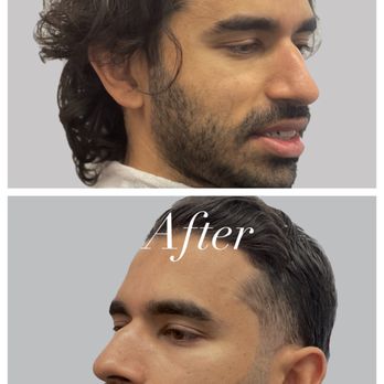 Bens Luxe Barber - Before and after haircut. - Barbers Near Me - Dallas, Texas Bens Luxe Barber - Before and after haircut. - Barbers Near Me - Dallas, Texas