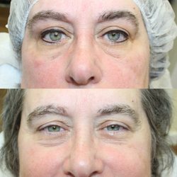 Accent Permanent Makeup Studio - Successful permanent eyeliner! Really opens and highlights her beautiful eyes!