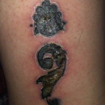 Rebel Ink Studio - Day 6; the puss started to become solid and form a scab - Tattoo Near Me - Goodyear, Arizona