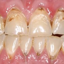 Chris Mohler DDS