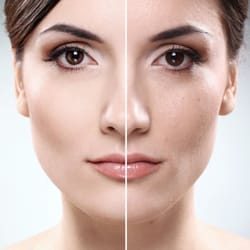 JMR Cosmetics - Microdermabrasion bei JMR Cosmetics