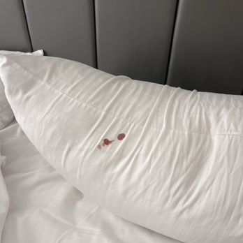 Flamingo Las Vegas - Blood stains on pillow case stained - Hotels Near Me - Las Vegas, Nevada Flamingo Las Vegas - Blood stains on pillow case stained - Hotels Near Me - Las Vegas, Nevada