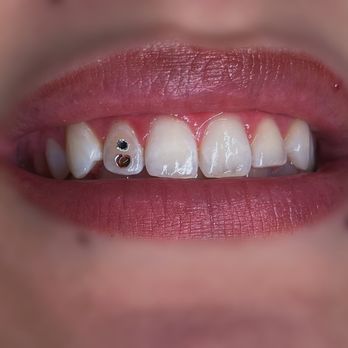 Kawaii Tooth Gems - Jewelry Near Me Kawaii Tooth Gems - Jewelry Near Me