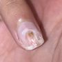 Photo of Rose Nails