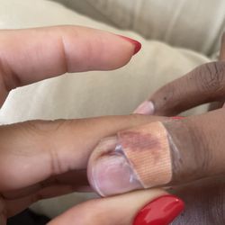 Nail Spree - Blood.. after re-bandaging 3 times.
