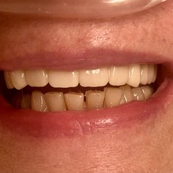 Avid Dental - After