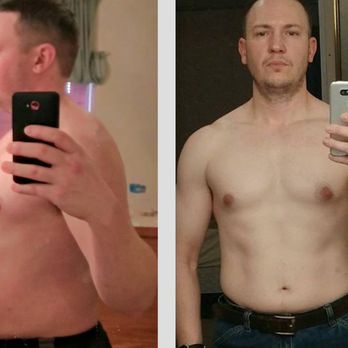 Temeculas Weight Loss Transformation - Progress Pics - Weight Loss Centers Near Me - Temecula, California Temeculas Weight Loss Transformation - Progress Pics - Weight Loss Centers Near Me - Temecula, California