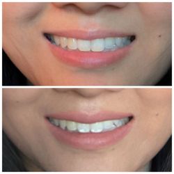 Smile Vegas Dental