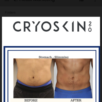 Cryo Body Spa - Our new Cryoskin 2.0! Immediate Results: Naturally Removes Fat, Tightens Skin and Eliminates Cellulite! - Cryotherapy Near Me - South Miami, Florida Cryo Body Spa - Our new Cryoskin 2.0! Immediate Results: Naturally Removes Fat, Tightens Skin and Eliminates Cellulite! - Cryotherapy Near Me - South Miami, Florida